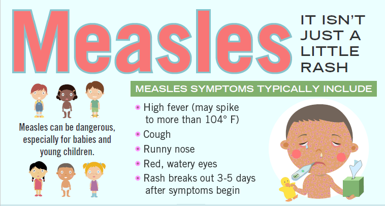 measles